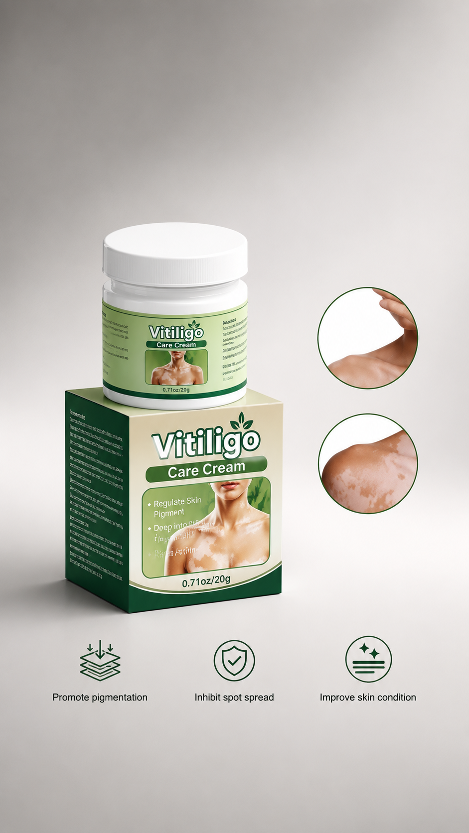 VITILIGO Care Cream - Restore your Natural Beauty (Pack of 2)
