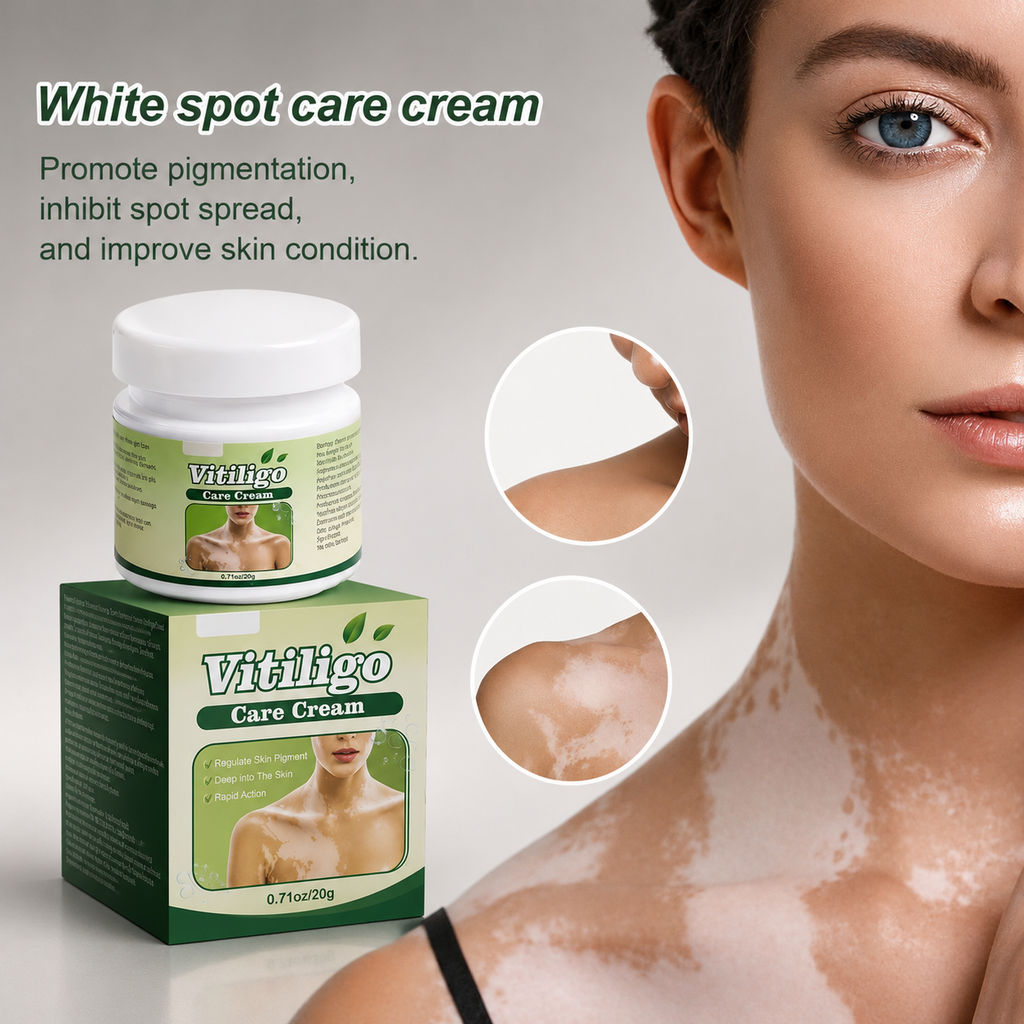 VITILIGO Care Cream - Restore your Natural Beauty (Pack of 2)